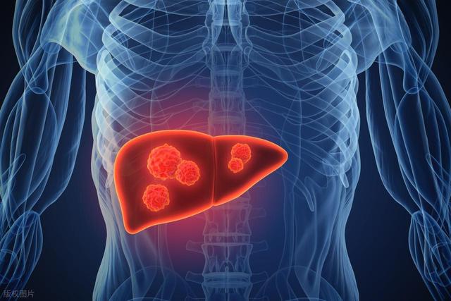 身上的「紅點」為啥越來越多，是肝臟出毛病了？給你嘮嘮紅點是啥