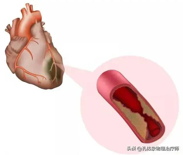 肩膀疼痛是怎麼回事？本文告知您9種病因，讓您再也不盲目諮詢