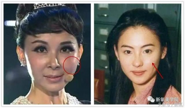 測測你是〝骨相美〞還是〝皮相美〞?關鍵在這5點!快來測試吧!