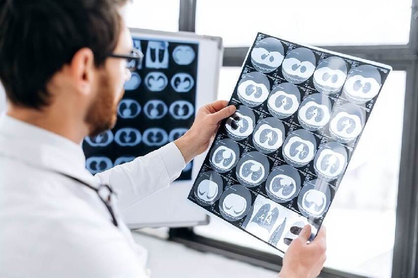 老年癡呆最早信號不是忘事！醫生：頻繁出現這幾個異常，大腦已病變