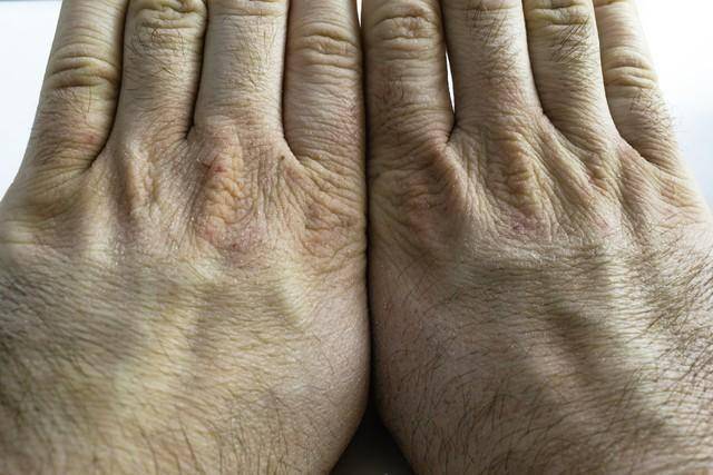 人活多久看手掌就能知？醫生直言：長壽的人，手掌或有這3個特徵