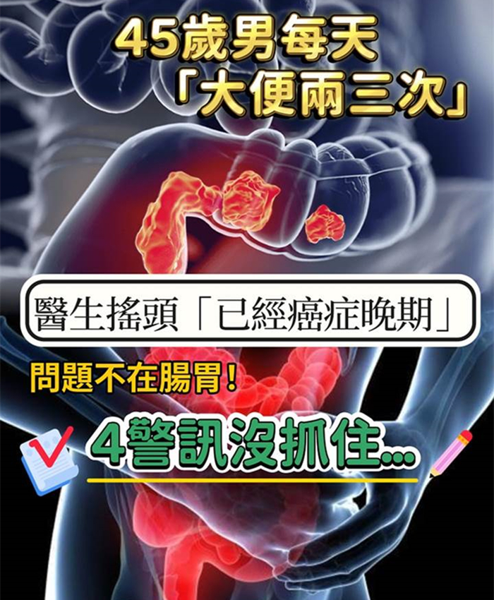 才45歲！他每天「大便兩三次」以為消化好，醫生搖頭「已經癌癥晚期」4異常沒注意