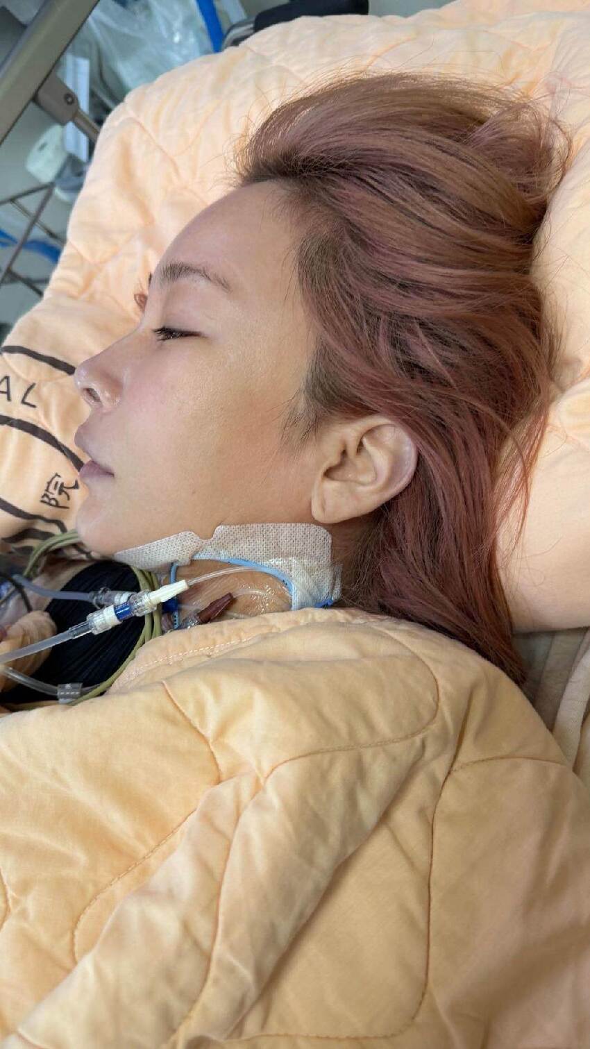 溫嵐命危搶救10天！經紀人揪心回應病況，經過搶救治療...