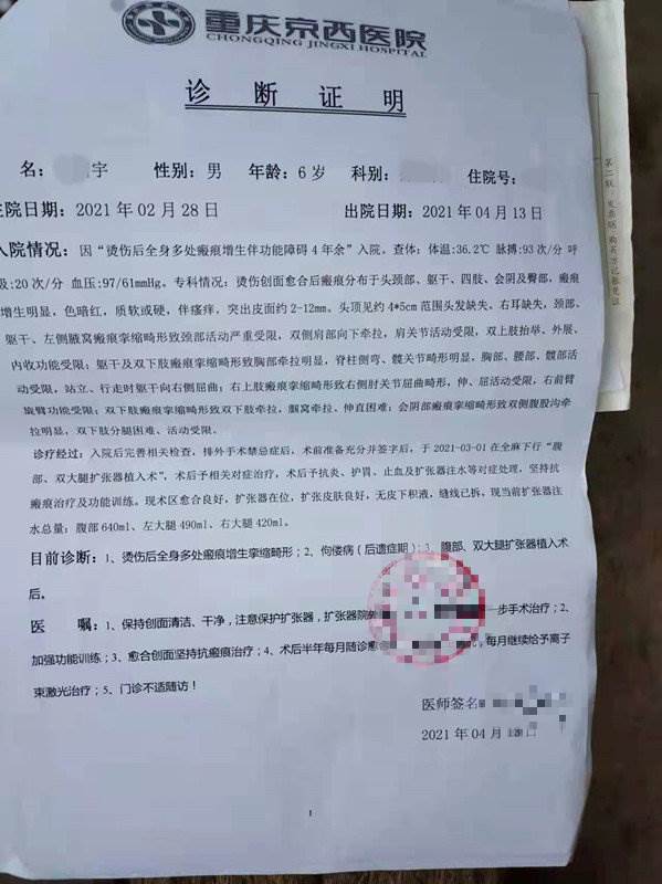 跌進油鍋！3歲童「全身被炸爛」慘叫　母崩潰：只剩五官