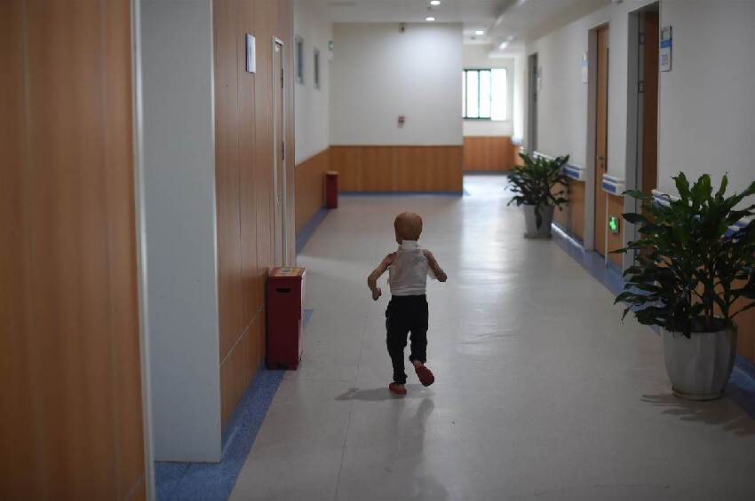 跌進油鍋！3歲童「全身被炸爛」慘叫　母崩潰：只剩五官