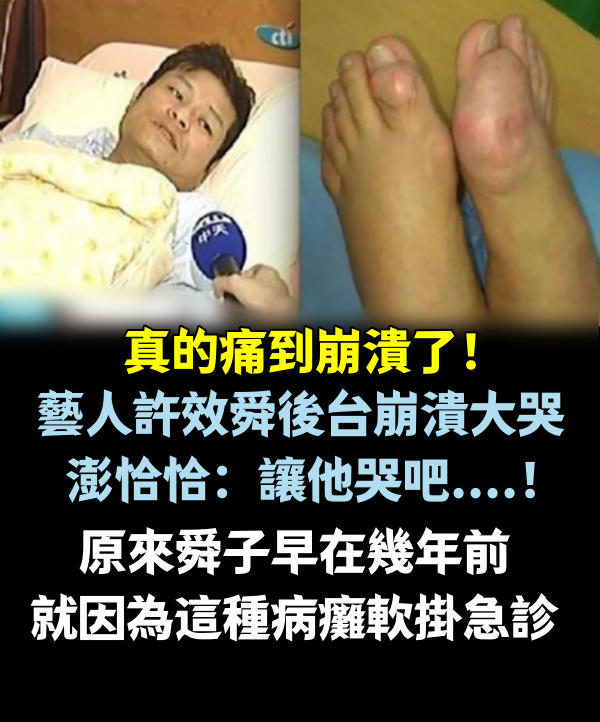 真的痛到崩潰了！藝人「許效舜」後台崩潰大哭，澎恰恰：讓他哭吧....！原來舜子早在幾年前就因為這種病癱軟掛急診....