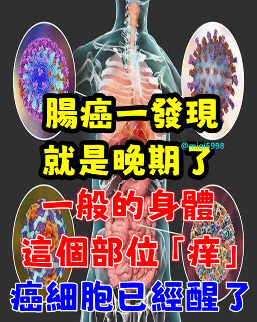 腸癌一發現就是晚期！一般身體這個部位「癢」：癌細胞已經醒了