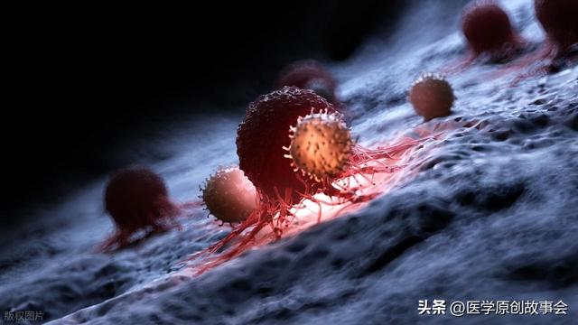 醫生總結：人患惡性腫瘤前1年，身體一般會出現6個預警信號