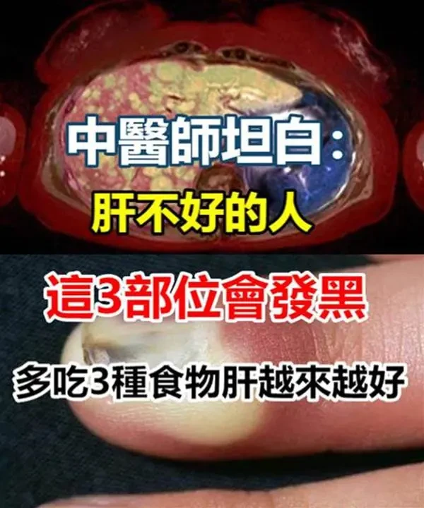 中醫師說了:肝不太好的人「3部位會發黑」 只需「多吃3種食物」肝會越來越好