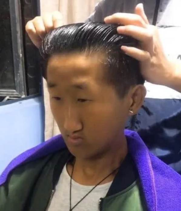 五官超擠！他靠「超小眼睛」狂吸百萬粉，下定決心「去動割雙眼皮」術后他哭了：救不回來了