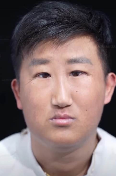 五官超擠！他靠「超小眼睛」狂吸百萬粉，下定決心「去動割雙眼皮」術后他哭了：救不回來了