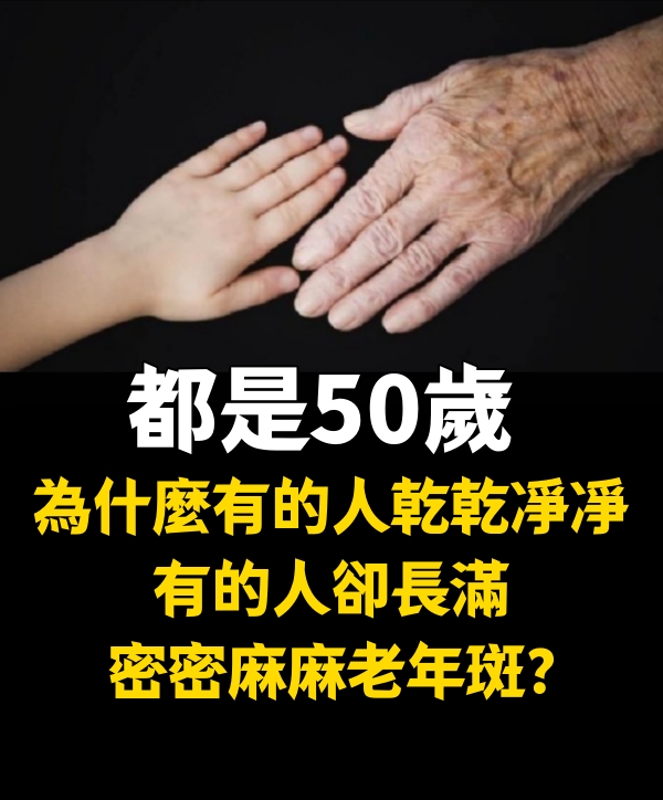 都是50歲，為什麼有的人乾乾凈凈，有的人卻長滿密密麻麻老年斑？