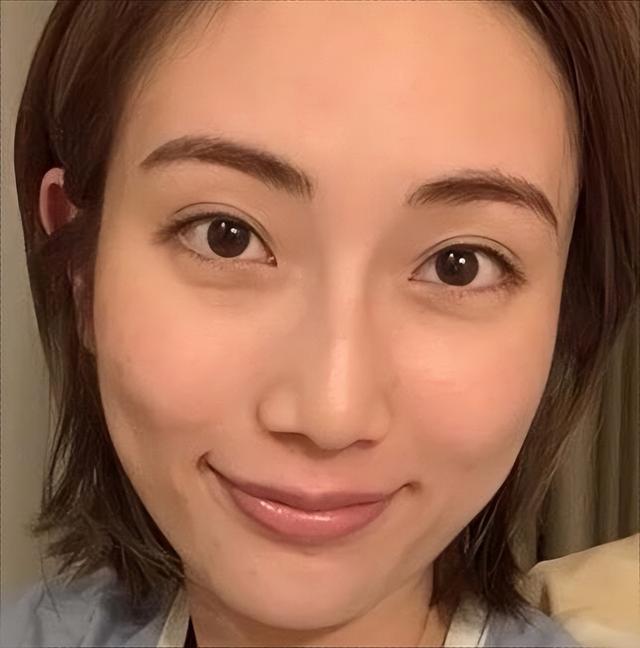 TVB前女星整容醫美長達十年，踏入娛樂圈不自信，打過六種美容針