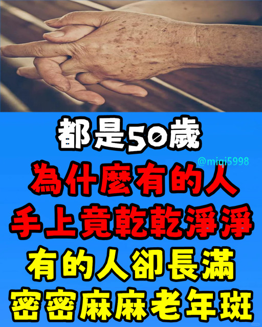 都是50歲，為什麼有的人乾乾凈凈，有的人卻長滿密密麻麻老年斑？