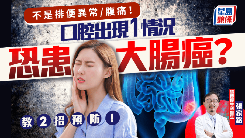 大腸癌前兆｜不是排便異常/腹痛！口腔出現1情況恐患大腸癌？醫生教2招預防