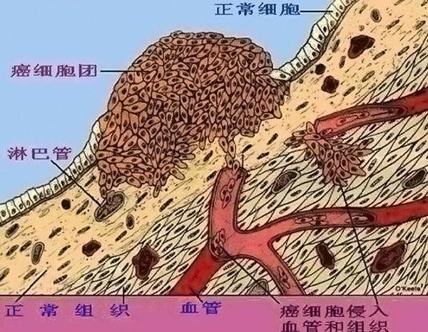 餵養癌細胞？專家：4類饅頭多吃一口癌近一步，別再買回家了