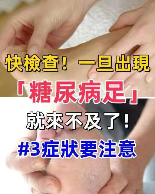 快檢查！一旦出現「糖尿病足」就來不及了 #3個症狀要注意