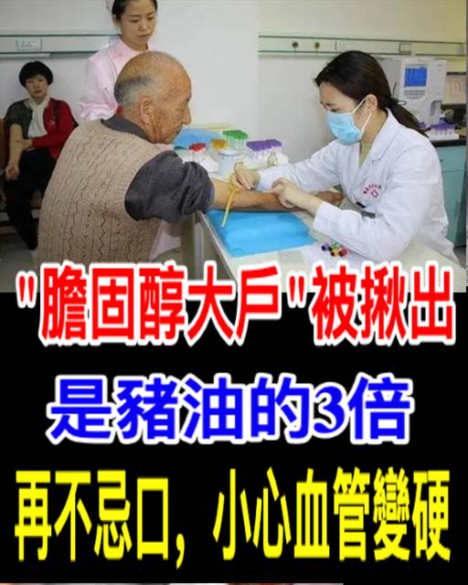 「膽固醇大戶」被揪出，是豬油的3倍，忠告:再不忌口，小心血管變硬