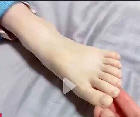 女兒長了12個腳指頭,媽媽問「要不要切掉」,回答惹網友怒贊:這思想很酷。