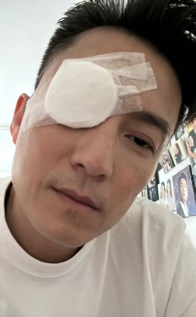 擔心!TVB視帝自曝接受眼部手術,一隻眼被紗布包裹,狀態疲憊