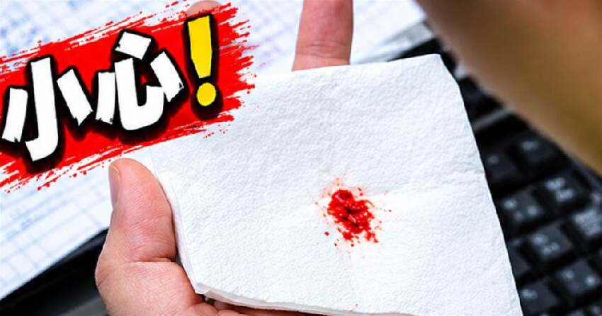 肺癌發出第一個信號！大多「顯示在喉嚨上」 醫生示警「很多人沒在意」：一拖就是晚期