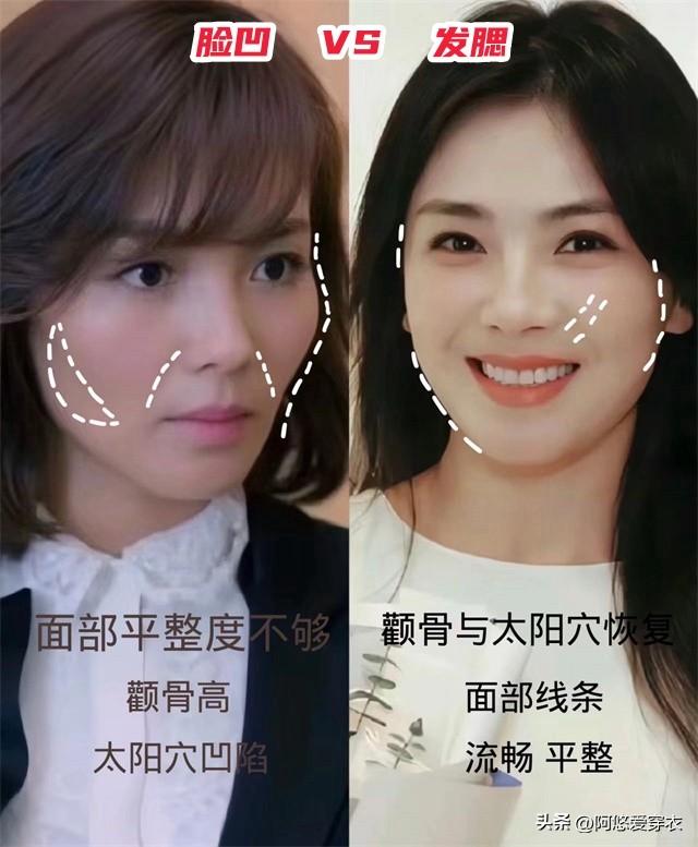比發腮更可怕的是臉凹,刻薄顯老,難怪老一輩人都喜歡「富貴花」