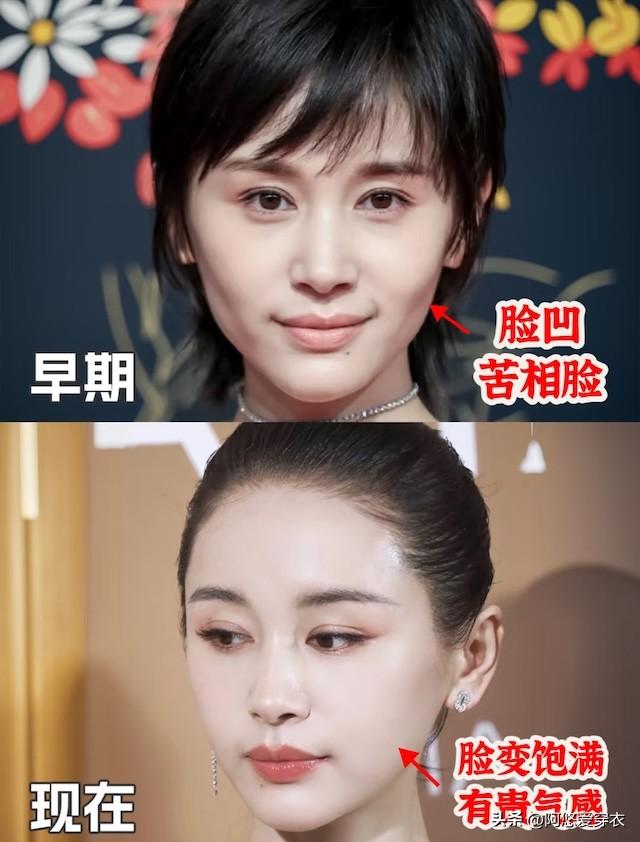 比發腮更可怕的是臉凹,刻薄顯老,難怪老一輩人都喜歡「富貴花」
