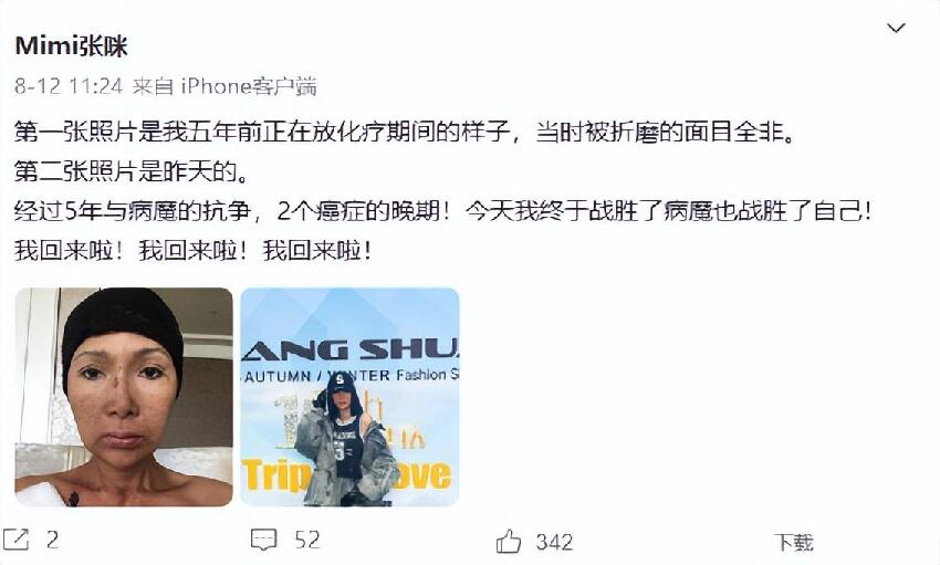 54歲女歌手三度患癌！確診舌癌要「切掉一半舌頭」，她淚曝：可能將永遠無法唱歌