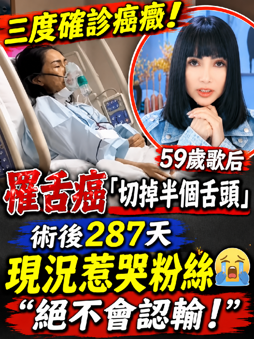 三度確診癌癥！59歲歌后罹舌癌「切掉半個舌頭」術後287天「現況惹哭粉絲」：絕不會認輸