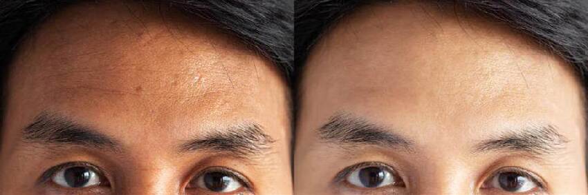 很多人都不知道， 天要收人之前， 必定會有這5種徵兆，切記一切都是天