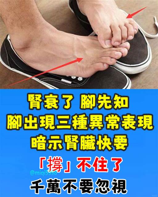 腎衰了，腳先知！腳出現「三種異常」表現　暗示腎臟快要「撐」不住了 ：千萬不要忽視