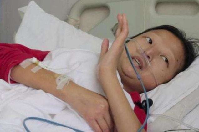 為了救弟弟!24歲姐姐「連5年吃辣椒配飯」僅21.5公斤過世 醫嘆:「已無法治療」