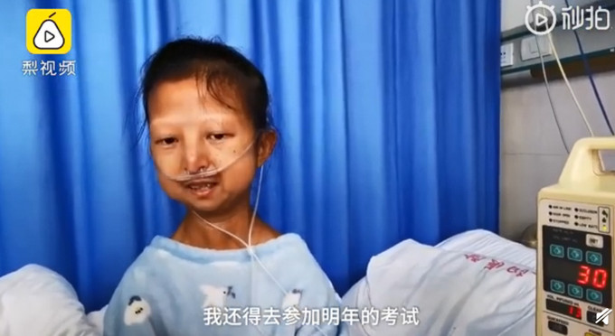 為了救弟弟!24歲姐姐「連5年吃辣椒配飯」僅21.5公斤過世 醫嘆:「已無法治療」