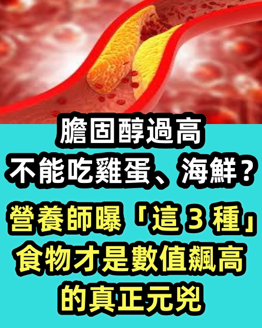 膽固醇過高不能吃雞蛋、海鮮？營養師曝「這 3 種」食物才是數值飆高的元兇