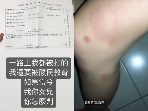 舊愛撕破臉！罔腰公開遭鳳梨「67秒痛毆片」 淚曝診斷書「全身8處受傷送醫」：不想再忍了