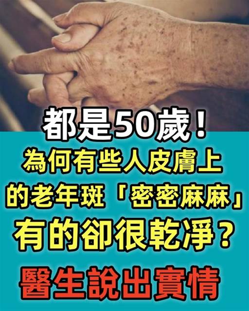 都是50歲，為什麼有的人乾乾凈凈，有的人卻長滿密密麻麻老年斑？