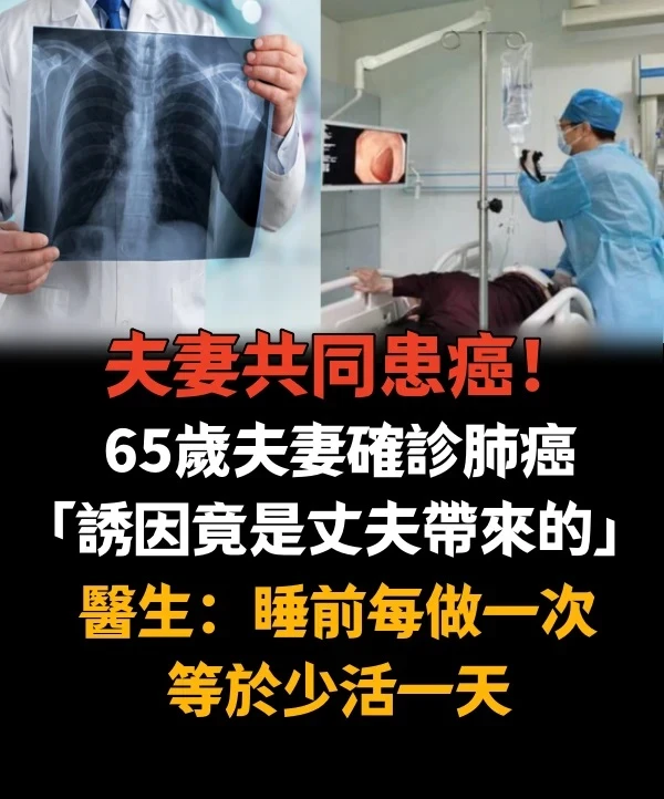 夫妻共同患癌！65歲夫妻確診肺癌「誘因竟是丈夫帶來的」，　醫生提醒：睡前每做一次等於少活一天