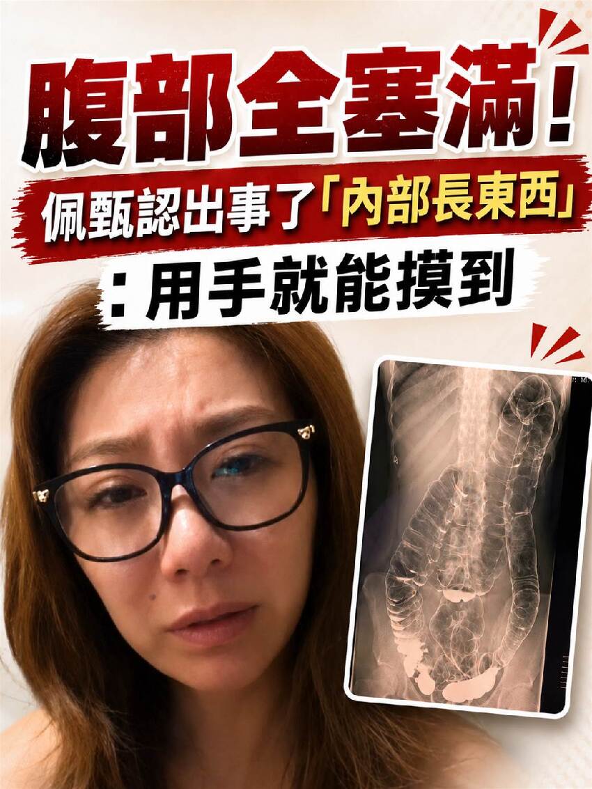 腹部全塞滿!!!  佩甄認出事了「內部長東西」：用手就能摸到