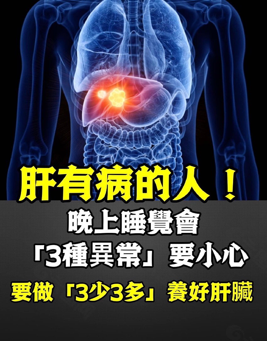 肝有病的人！晚上睡覺會「3種異常」要小心，要做「3少3多」養好肝臟