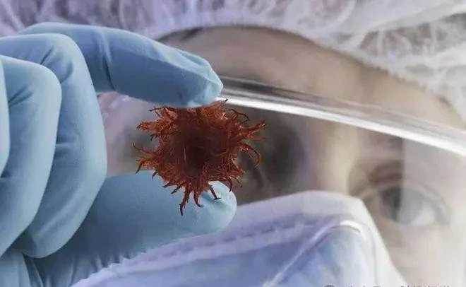 癌最開始形成時，人一般會感覺4處不對勁，但少有人重視！