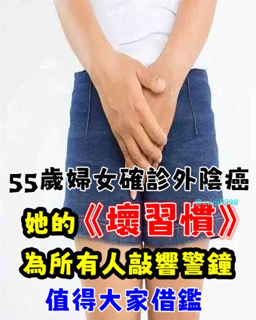 55歲婦女確診外.陰癌！她的《壞習慣》為所有人敲響警鐘！值得借鑑