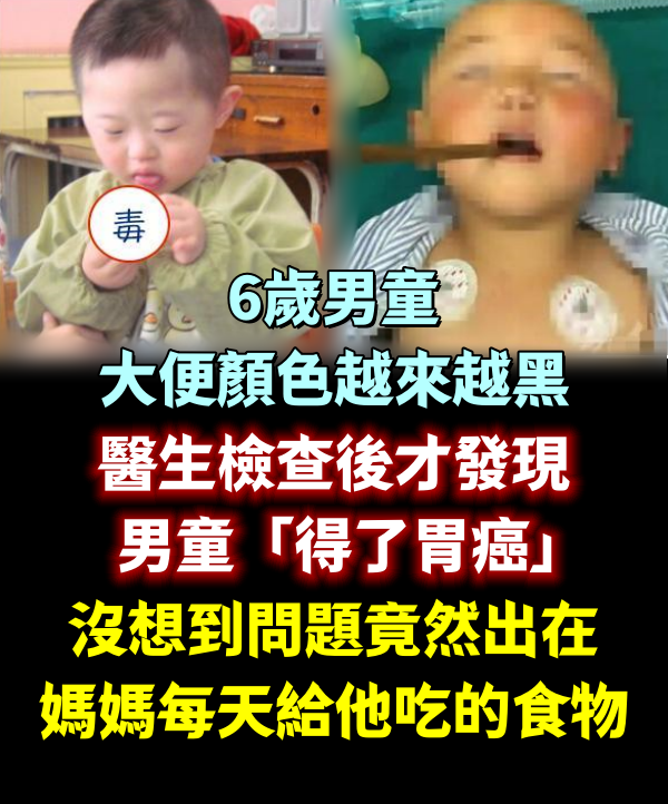 6歲男童大便顏色越來越黑，醫生檢查後才發現男童「得了胃癌」！沒想到問題竟然出在媽媽每天給他吃的「這個食物」