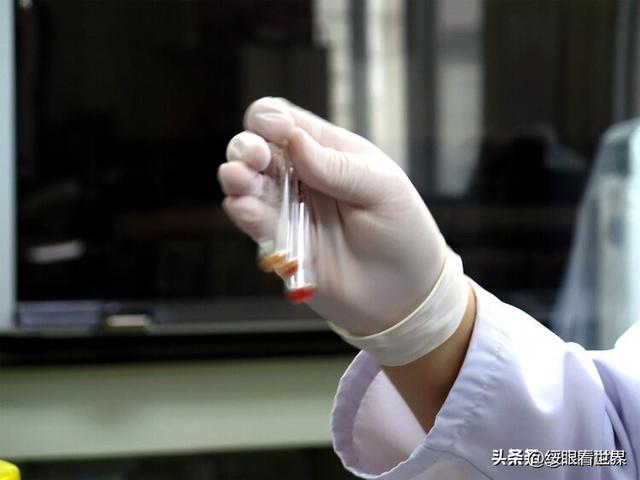 血型和罹癌率有關！醫療團隊花25年研究「獲驚人發現」　這血型「堪稱幸運兒」命最長