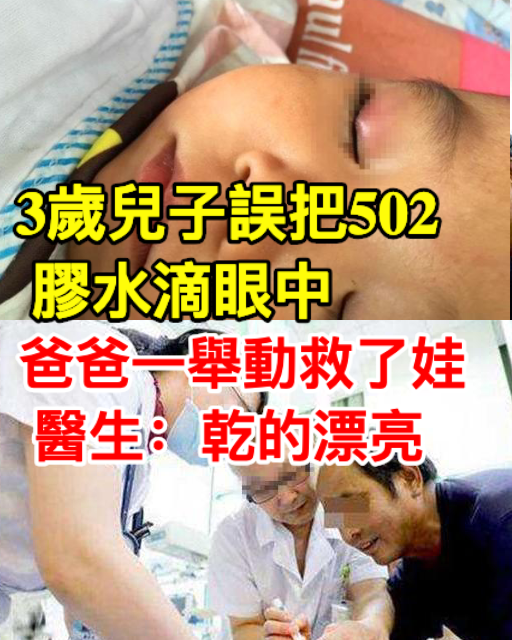 3歲兒子誤把502膠水滴眼中，爸爸一個舉動救了娃，醫生稱讚做得對