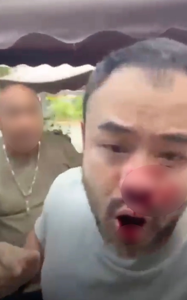 突發！香港男星直播遇襲，遭光頭男子毆打出血，與娛樂圈多人結怨