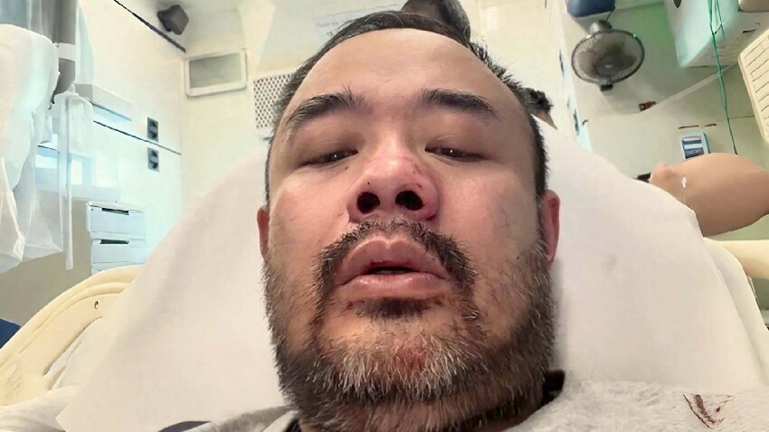 突發！香港男星直播遇襲，遭光頭男子毆打出血，與娛樂圈多人結怨