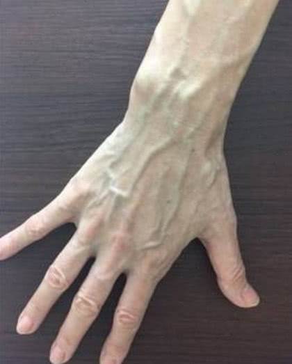 女人手上青筋明顯，究竟是好事還是壞事？真相讓人意外