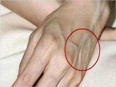 女人手上青筋明顯，究竟是好事還是壞事？真相讓人意外
