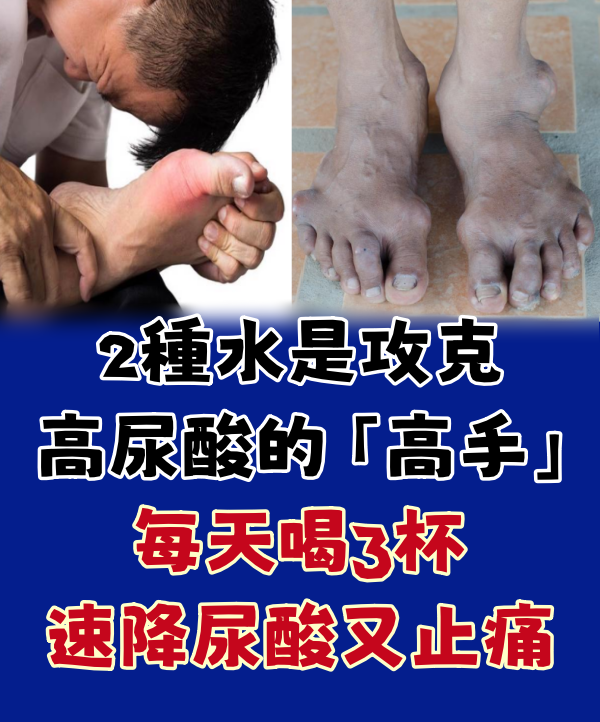 2種水是攻克高尿酸的「高手」,每天喝3杯,速降尿酸又止痛