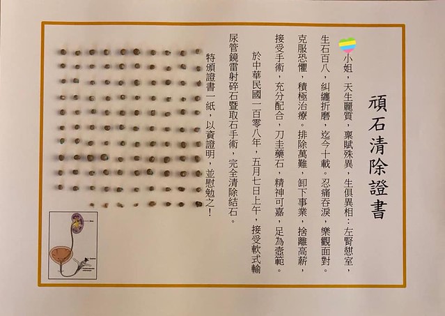 明明很注重養生！于美人急入院「拿出108顆腎結石」　醫師搖頭「保健食品惹的禍」：一堆人狂買